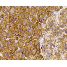Anti-TSC2/Tuberin antibody
