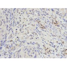 Anti-DPY30 antibody