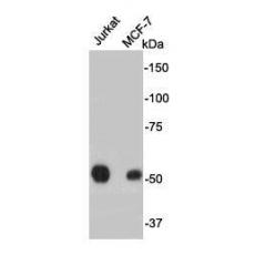 Anti-ERG antibody