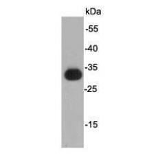 Anti-KT3 Tag antibody