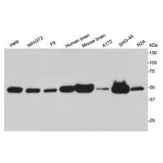 Anti-NSE antibody