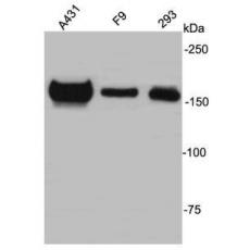 Anti-ZO2 antibody