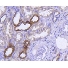 Anti-Glucose Transporter GLUT4 antibody