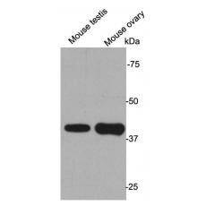 Anti-L1ORF1p antibody