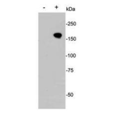 Anti-CRISPR-Cas9 antibody
