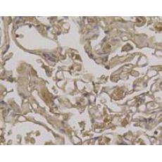 Anti-BECN1 antibody
