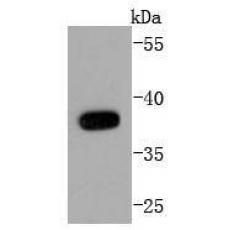 Anti-SIRT6 antibody