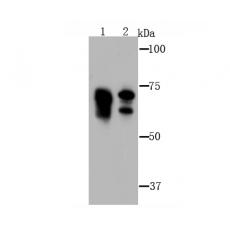 Anti-Metadherin(LYRIC) antibody