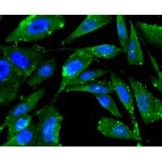 Anti-FPR2 antibody