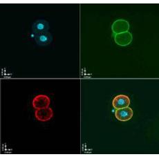 Anti-OOEP antibody