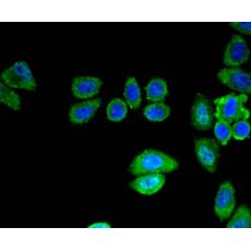 Anti-SIRT3 antibody