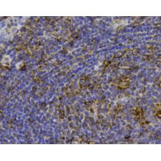 Anti-FPR1 antibody