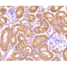 Anti-AKR1C1 antibody