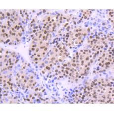 Anti-OGG1 antibody