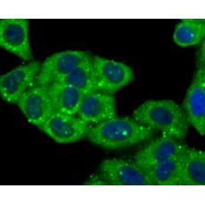 Anti-Cathepsin D antibody