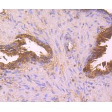 Anti-HLA Class 1 ABC antibody