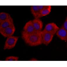 Anti-NM23 antibody