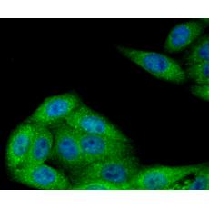 Anti-NSUN4 antibody