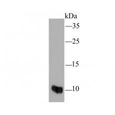 Anti-MRP8/S100A8 antibody