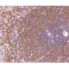 Anti-Tim3 antibody