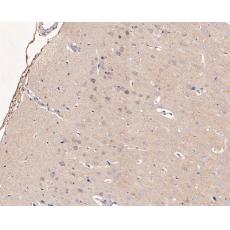 Anti-LGI1 antibody