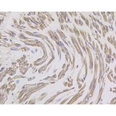 Anti-IL8 antibody