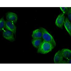Anti-Follistatin antibody