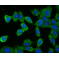 Anti-CD35 antibody