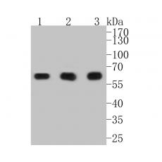 Anti-PKM antibody