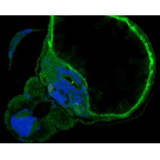 Anti-SHE antibody