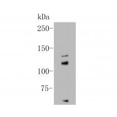 Anti-KCNMA1 antibody