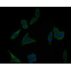 Anti-EMC10 antibody