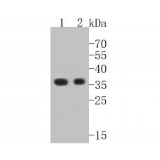 Anti-Claudin 18.1 antibody