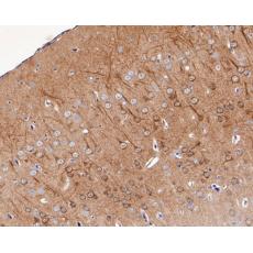 Anti-KChIP1 antibody