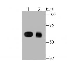 Anti-DLL4 antibody