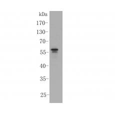 Anti-PPAR delta antibody