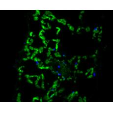 Anti-ECH antibody