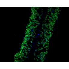 Anti-PAS2 antibody
