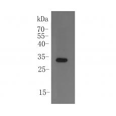 Anti-Mcur1 antibody