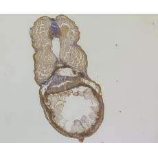 Anti-SARS2 antibody