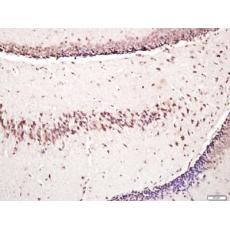 Anti-Osteocalcin antibody