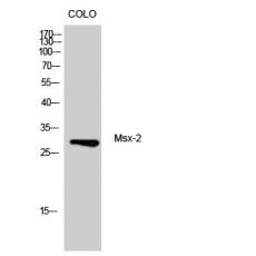 Anti-Msx-2 antibody