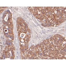 Anti-ETN1 antibody