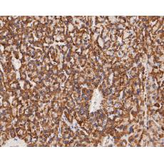 Anti-KCNK9 antibody