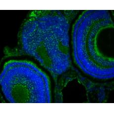 Anti-YARS2 antibody