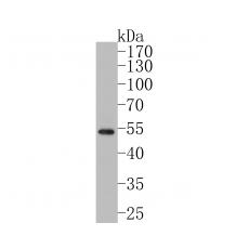 Anti-GATA3 antibody