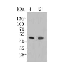 Anti-LIM1 antibody