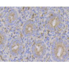 Anti-ERN1 antibody