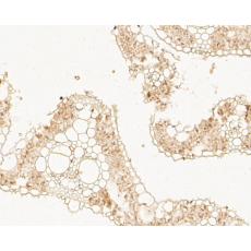 Anti-D14 antibody