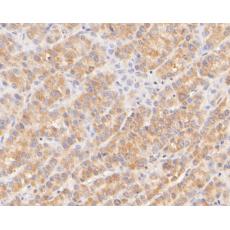 Anti-CPEB1 antibody